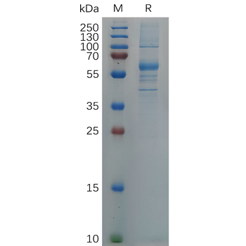 Human KIR2DL3 Protein, hFc Tag