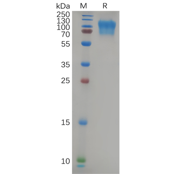 Human KIR2DL1 Protein, hFc Tag