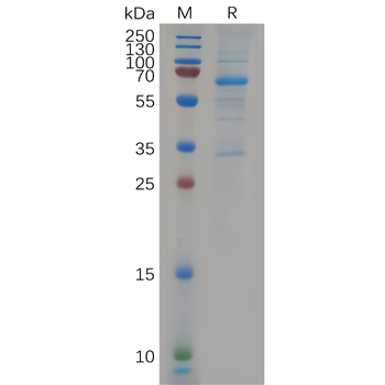 Human IL27RA Protein, hFc Tag