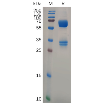 Human C5AR1 Protein, hFc Tag