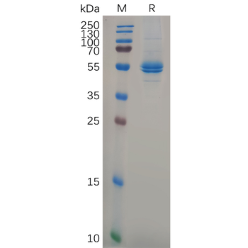 Human CD200R1 Protein, His Tag