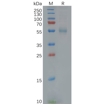 Human SSTR2 Protein, hFc Tag