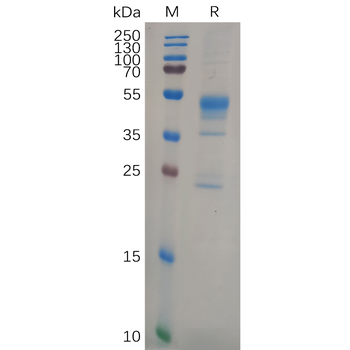 Human HLA-A Protein, hFc Tag