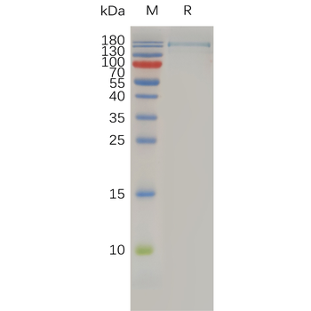 Human CCR8 Protein, mFc Tag