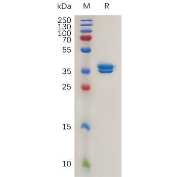 Human CEACAM8 Protein, His Tag