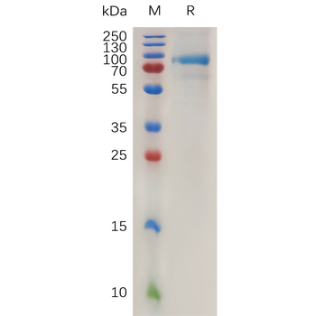 Human CD106 Protein, hFc Tag