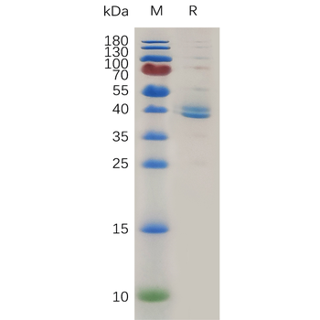 Human LAMP3 Protein, His Tag