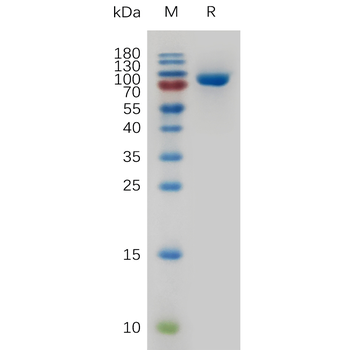 Human ASGR1 Protein, His Tag