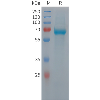 Human CCL27 Protein