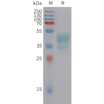 Human CCL5 Protein