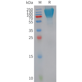 Human CCL3 Protein