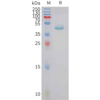Human IL-28A (C-6His) Protein