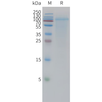 Human FGFa (154AA) Protein