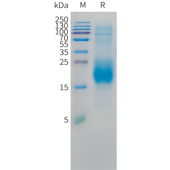 Human CCL11 Protein