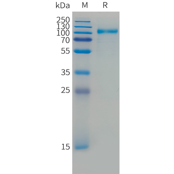 Human CXCL5 Protein