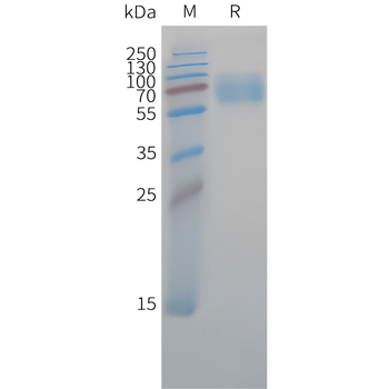 Human IL-20RA (C-Fc) Protein