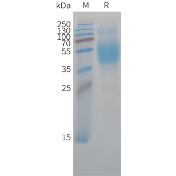 Human LongIGF-II Protein