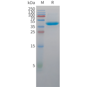 Human FGF-4 (136AA) Protein