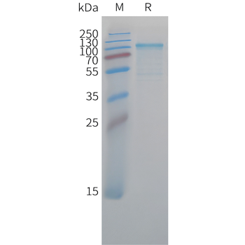 Human IL-29 (C-10His) Protein