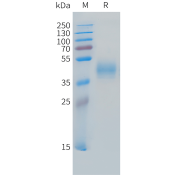 Human GDF-5 Protein