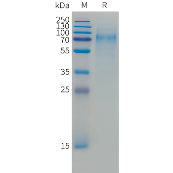 Human IL-2 Superkine (Mutant, C-6His) Protein