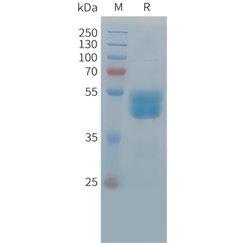 Human CXCL7 (C-6His) Protein
