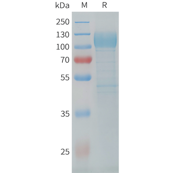 Human IGF-I (67AA) Protein