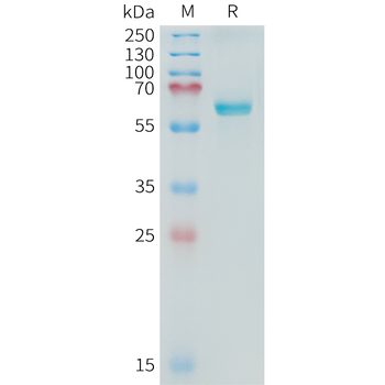 Human CCL18 (N-6His) Protein