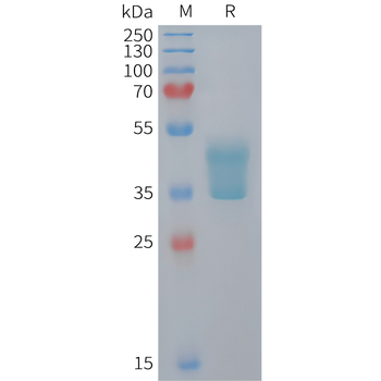 Human CXCL2 Protein