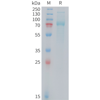 Human/Murine/Rat BDNF Protein