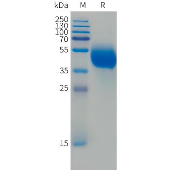 Human IL-16 Protein