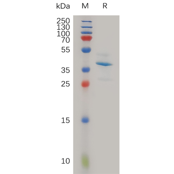 Human AGTR1 Protein, hFc Tag
