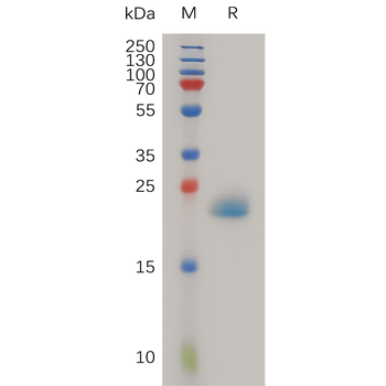 Human ULBP2 Protein, His Tag