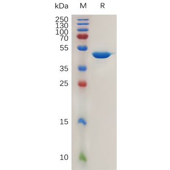 Monkeypox virus A29L Protein, His Tag