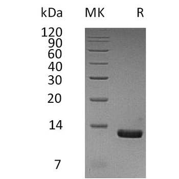 Human CXCL5 Protein, hFc Tag