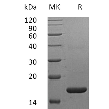 Human TNFRSF1B Protein, His Tag