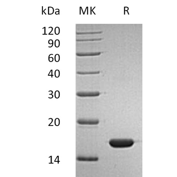 Human LRP10 Protein, His Tag