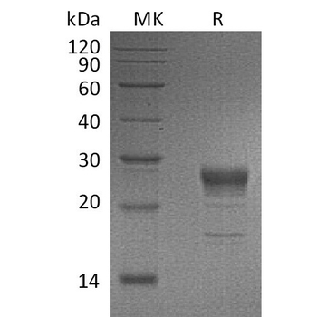 Human ICAM3 Protein, His Tag