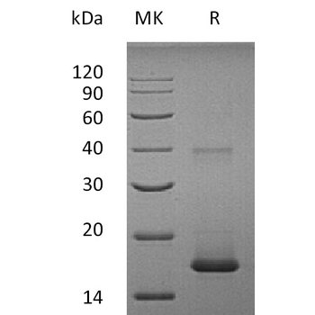 Human CXADR Protein, His Tag