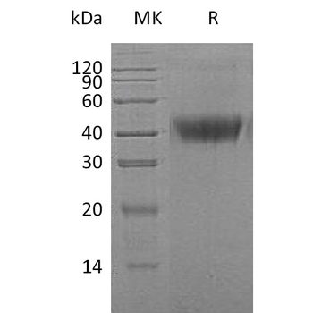 Human APLP2 Protein, His Tag