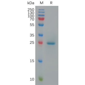 Human AZU1 Protein, His Tag