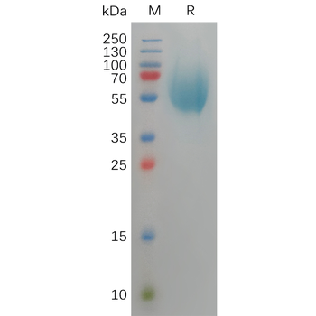 Human SEZ6L2 Protein, His Tag