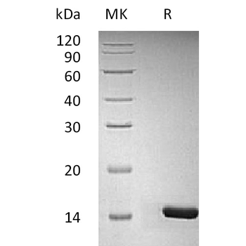 Human ALPP Protein, His Tag