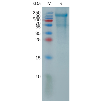 Human SIRPG Protein, His Tag