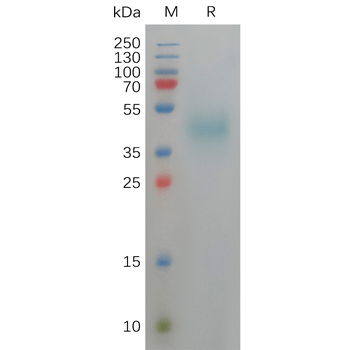 Human SPA17 Protein, His Tag