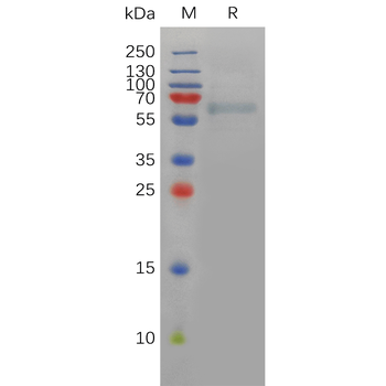 Human Selenop Protein, Flag Tag