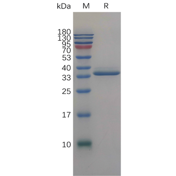 Human BCHE Protein, His Tag