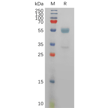 Human ANGPT2(19-496) Protein, His Tag