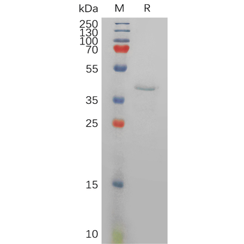 Human SLAMF8 Protein, His Tag