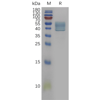 Human CD163 Protein, His Tag
